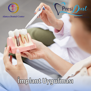 alanya implant fiyatları