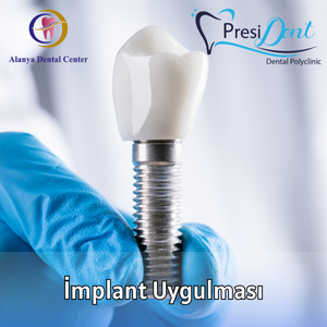 implant fiyatları