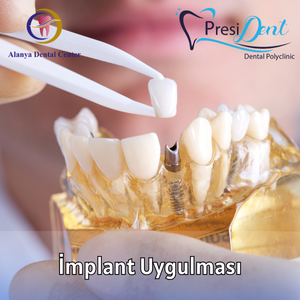 implant